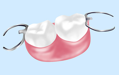 部分入れ歯