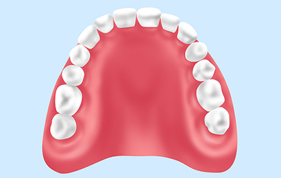 総入れ歯