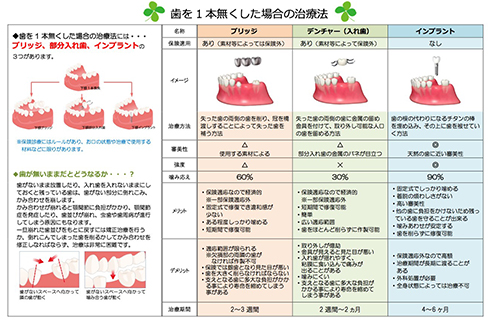 2. インプラントと従来の治療法の比較